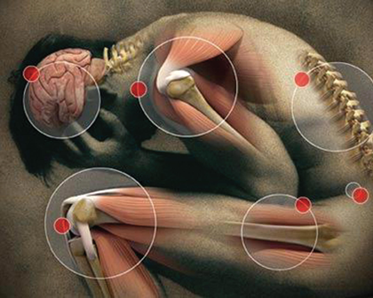 Cannabinoids and the Control of Pain