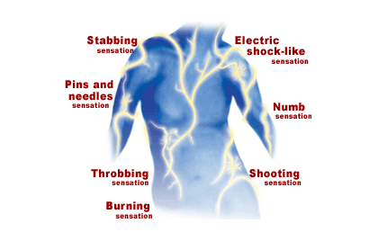 Neuropathic Pain